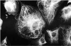 A cell fluorescently stained for vimentin