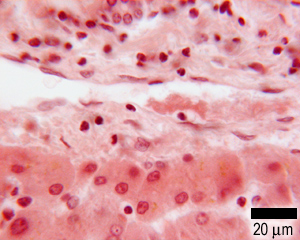 A section from the liver