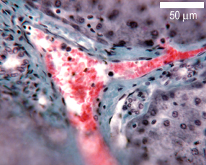 Section from the liver