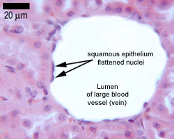 Endothelial cells