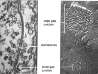 EM of two gap junctions between two cells, and a freeze fracture EM of the particles on the cytoplasmic face of the plasma membrane