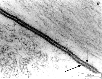 Electron micrograph of plasma membrane