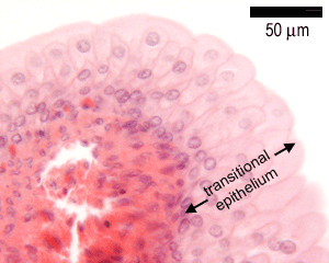 Transitional epithelium