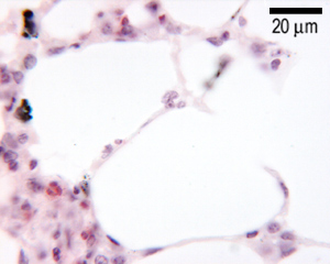 Alveoli