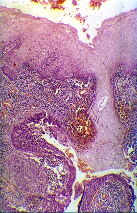 Mystery section of the oesophagus