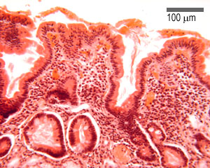 Duodenum
