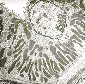 Distal convoluted tubule