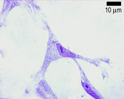 Fibroblast