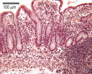 Ileum