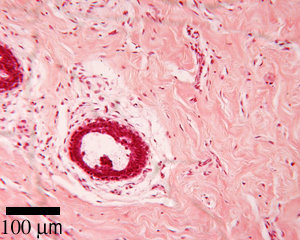 Connective tissue