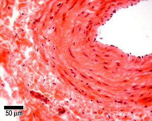Muscular vein