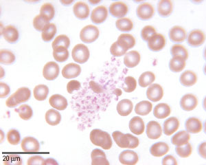 Platelets
