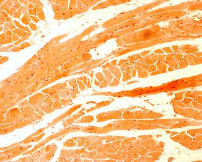 Tongue muscle