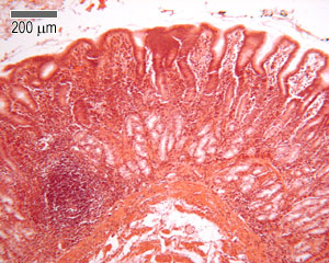 Pyloric region