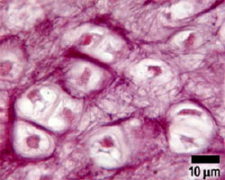Elastic cartilage