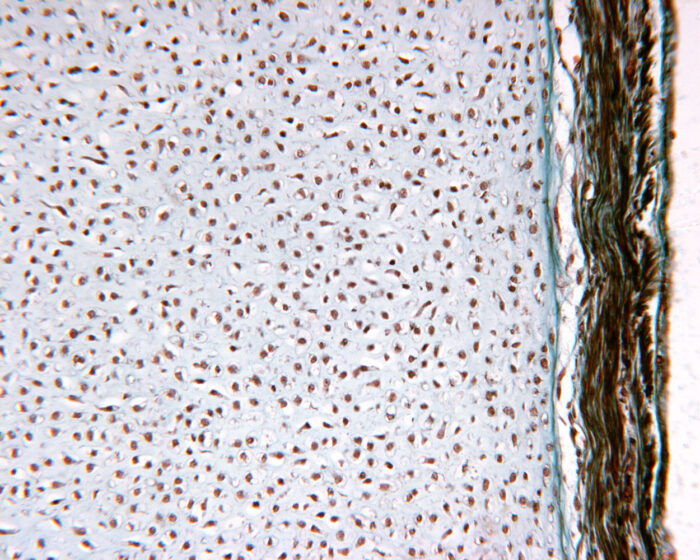 Section of cartilage