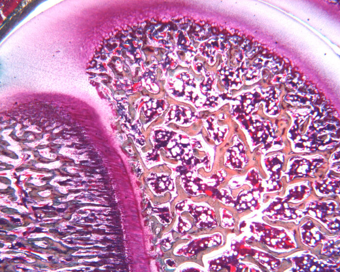 Epiphyseal growth plate