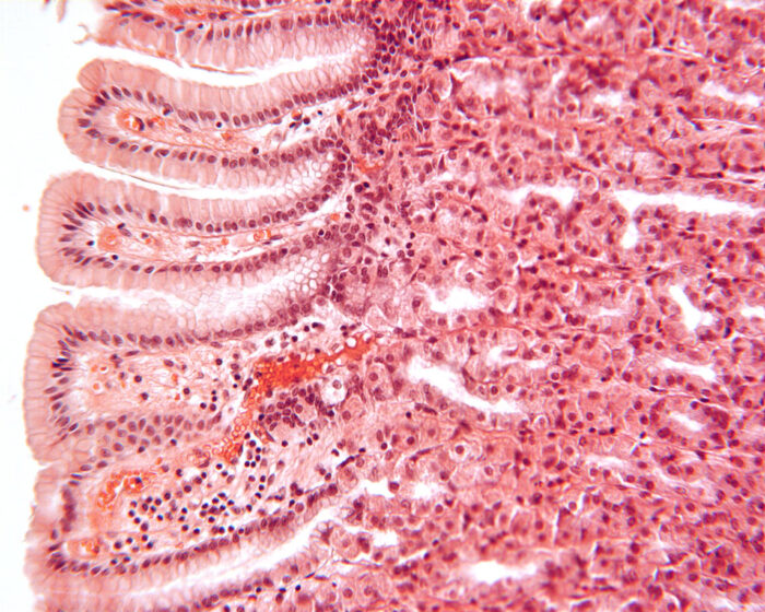 Gastric pits and glands in the fundus