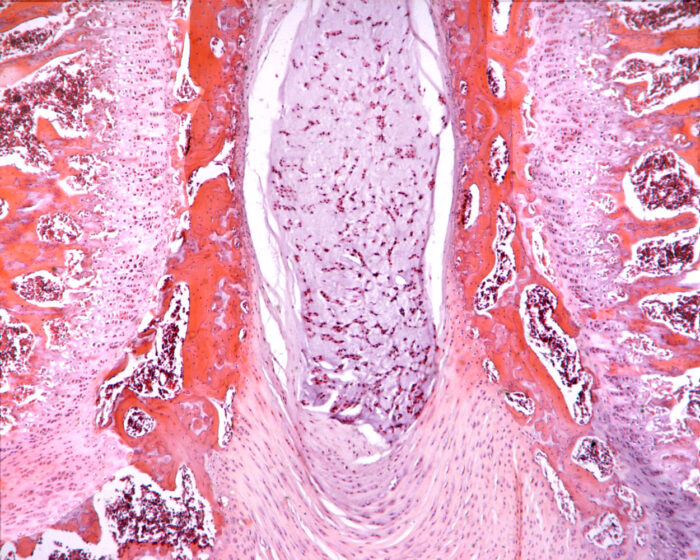 Fibrocartilage