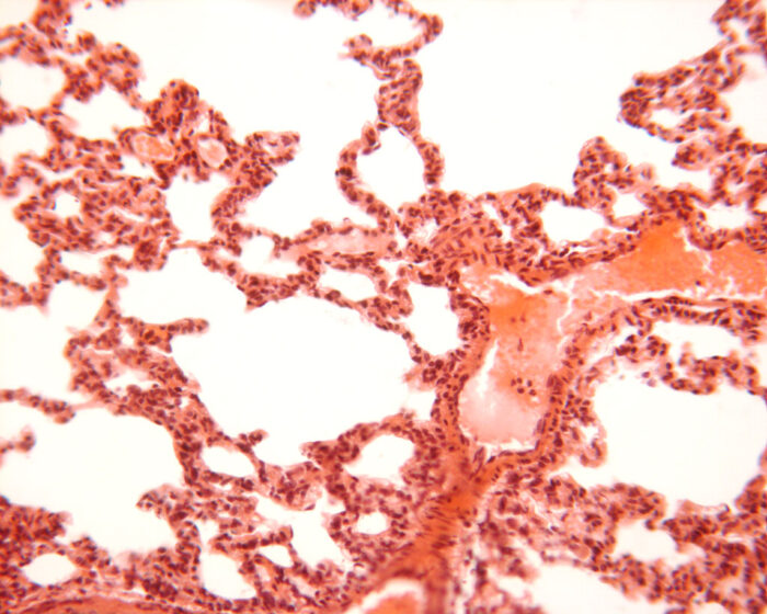 Lung top slide