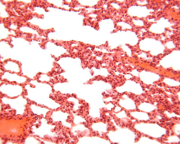 Lung section