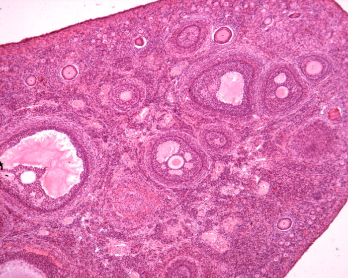Various stages of follicular development