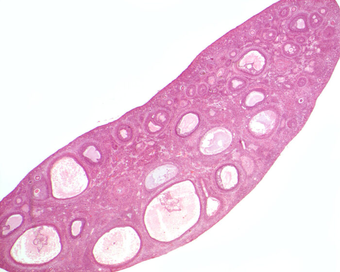 Ovary at low power