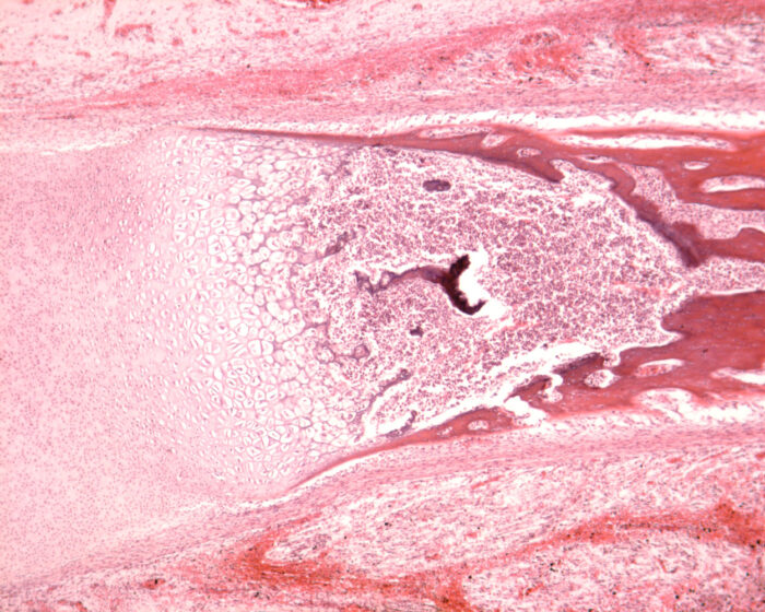 Longitudinal section through a fetal foot
