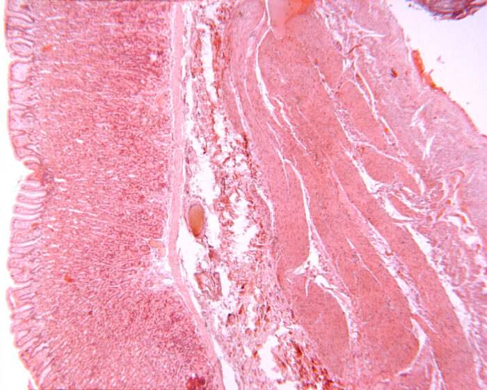 Stomach layers