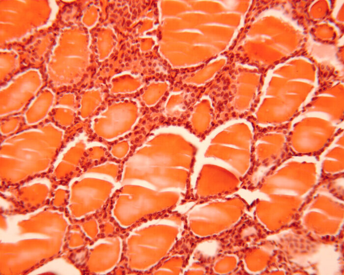 Thyroid gland